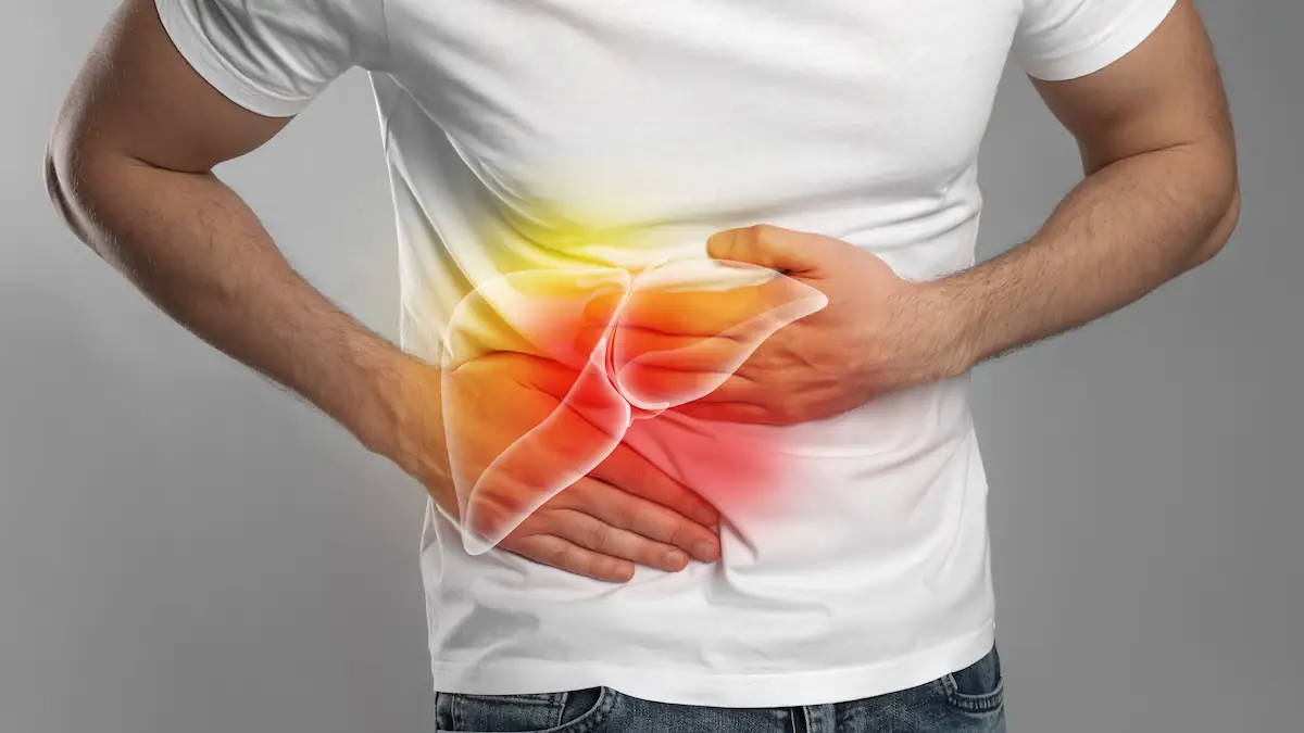 Leberzirrhose: Mann mit Bauchschmerzen und hervorgehobener Leber