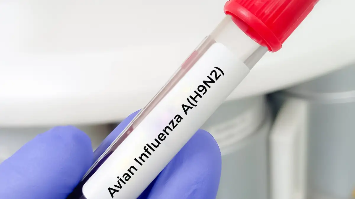 Teströhrchen mit Vogelgrippe-Aufschrift