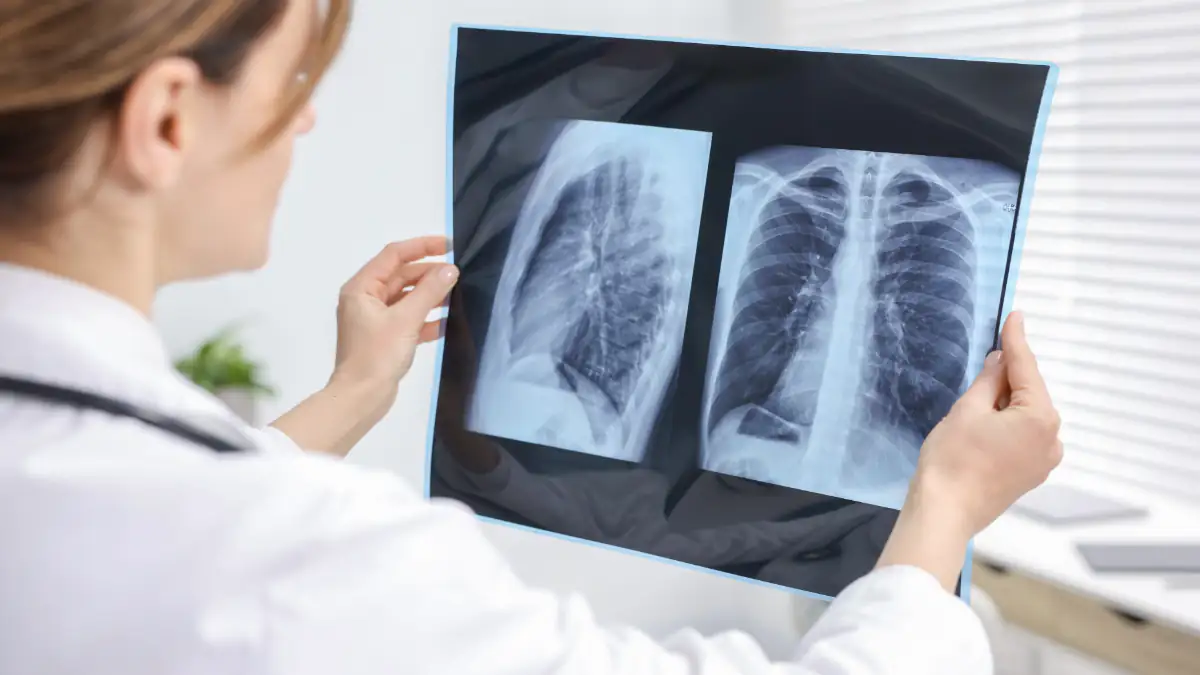 Ärztin zeigt Röntgenbilder der Lunge