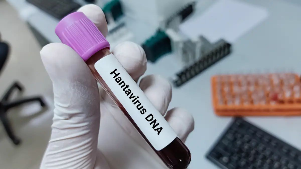 Hantavirus DNA im Labor