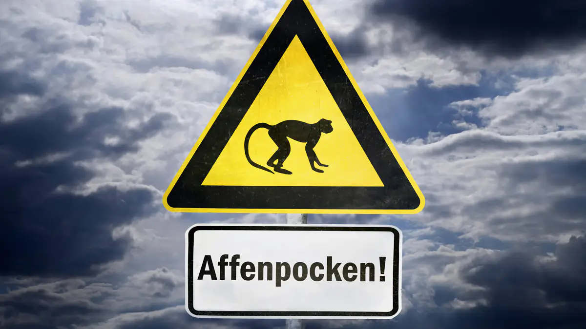 Affenpocken: Welche Personengruppen besonders gefährdet sind