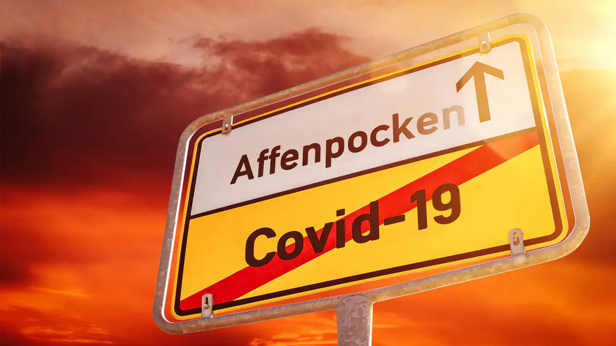 Affenpocken: Welche Symptome auftreten und wie man sich ansteckt