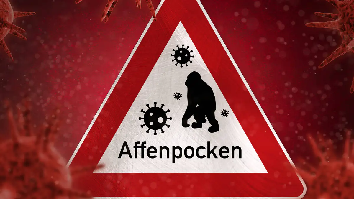 21 Tage: Erstes Land führt Affenpocken-Quarantäne ein