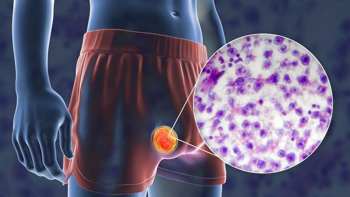 Hoden-Hirn? Forscher stellen unglaubliche Ähnlichkeit fest