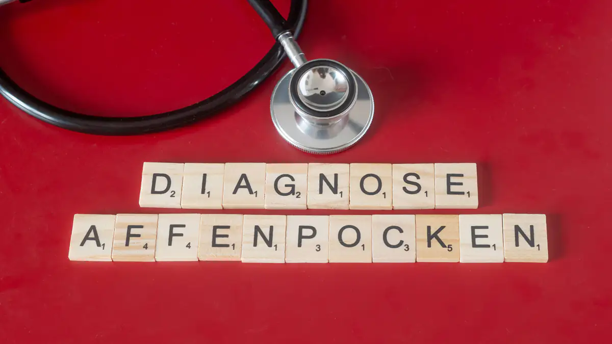 Affenpocken durch Astrazeneca?: Irre Theorie geht viral