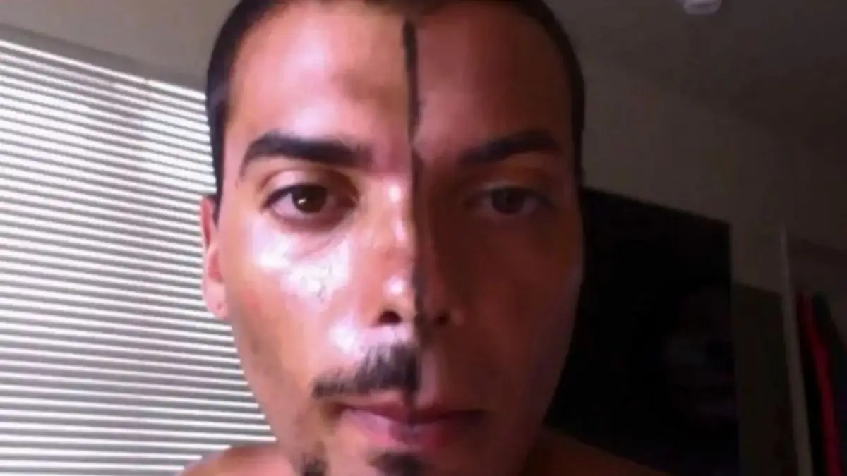 Beinahe gestorben: Mann überfällt Paar und will Sex-OP's an ihnen durchführen