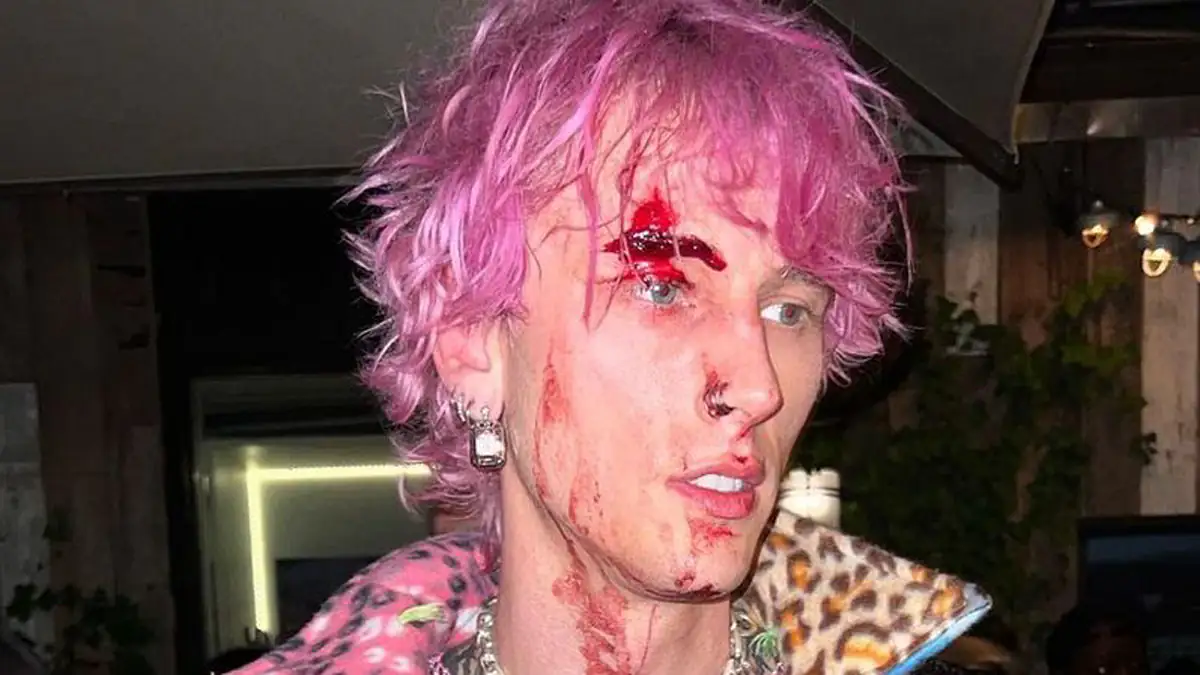 Blutiger Vorfall: Machine Gun Kelly zeigt sich mit Platzwunde auf Instagram
