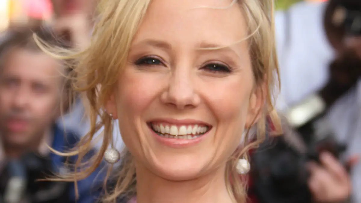 Anne Heche: Gerichtsmedizin gibt Todesursache bekannt