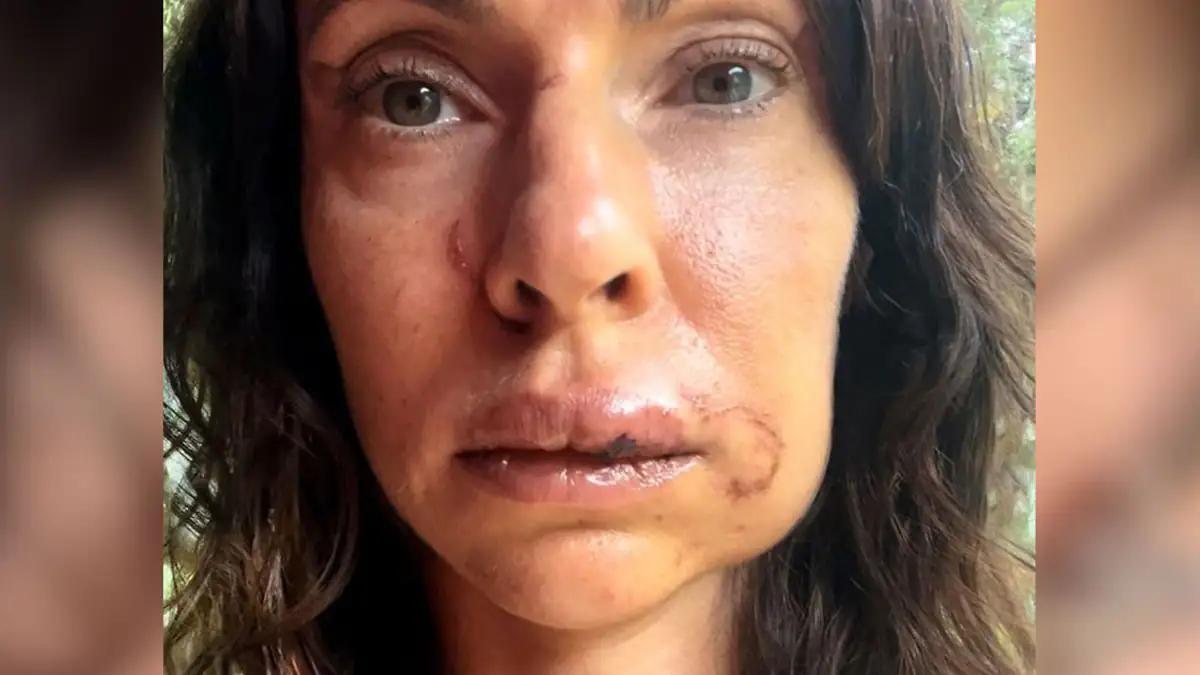 Versuchte Vergewaltigung: Schock für Dschungelcamp-Kandidatin Jana „Urkraft“ Pallaske