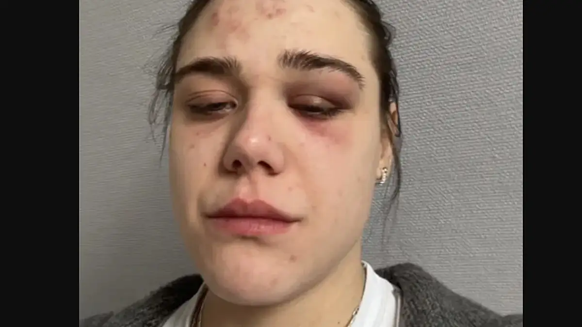 TikTok-Star auf offener Straße zusammengeschlagen