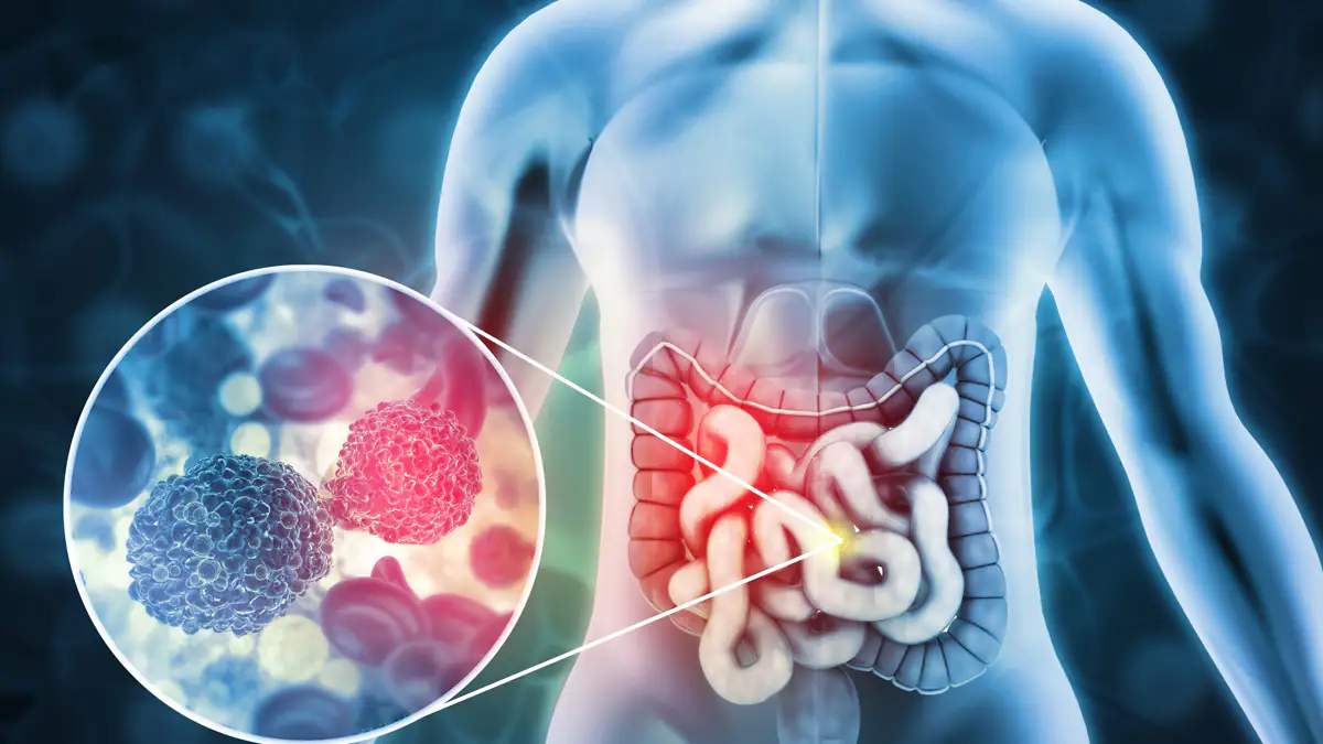 Erhöht das Krebsrisiko: Forscher warnen vor beliebtem Getränk