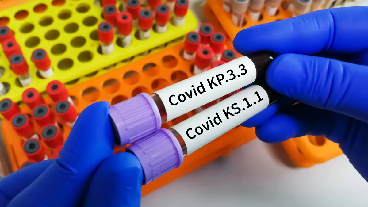 Corona-Variante KP.3.1.1 breitet sich aus: Experten warnen vor neuem Verlauf