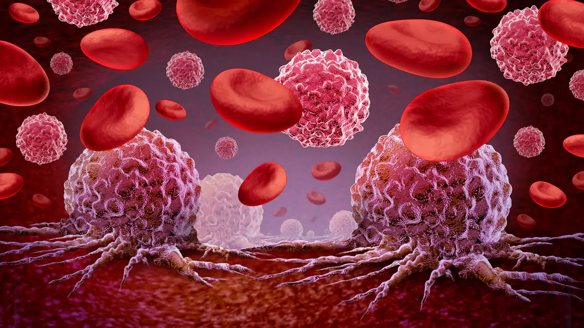 Dank neuer Therapie: Krebs verschwindet bei über 50 Prozent der Patienten