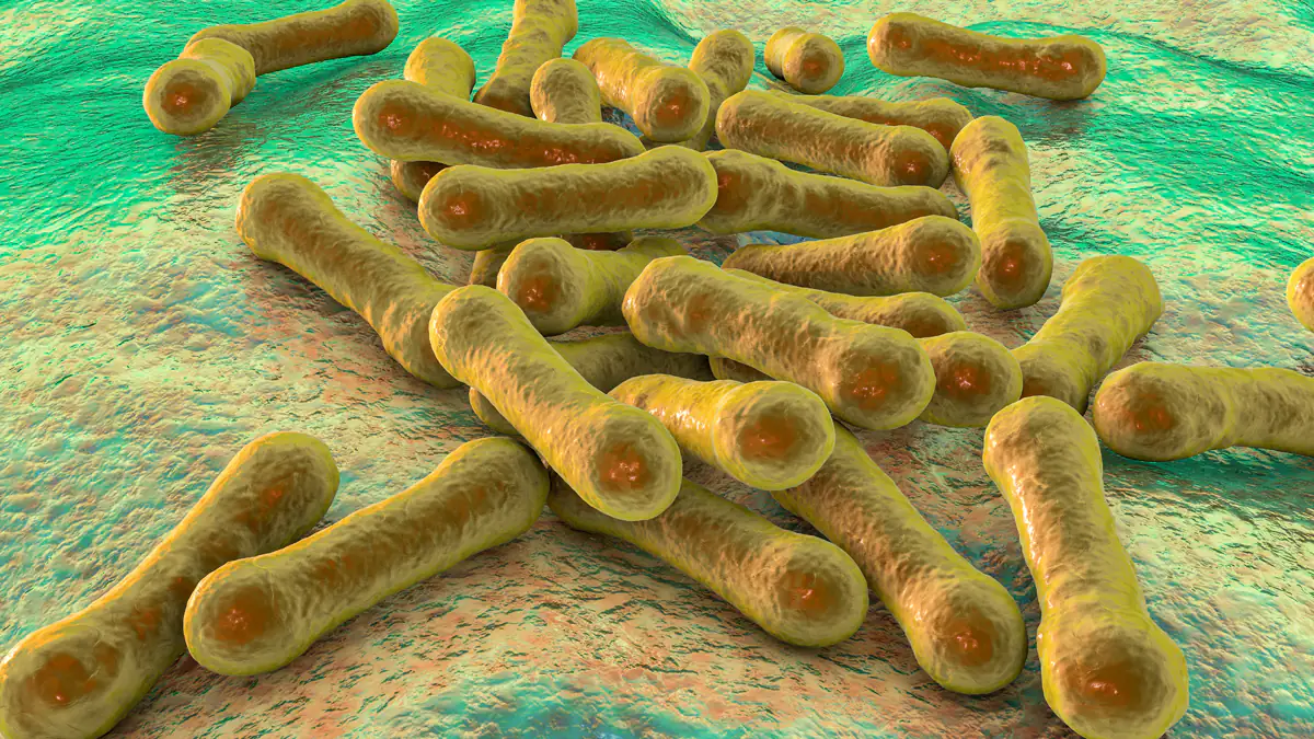 Diphtherie: RKI warnt vor Ausbruch in Deutschland