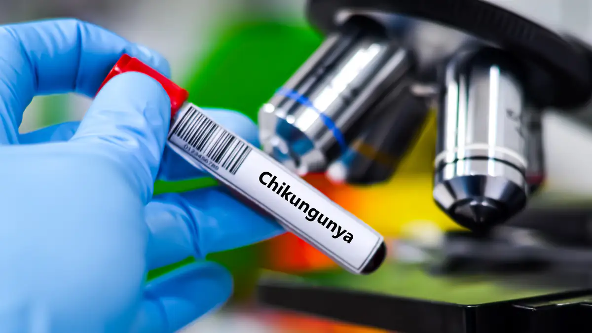 WHO warnt: Chikungunya-Virus breitet sich in China aus