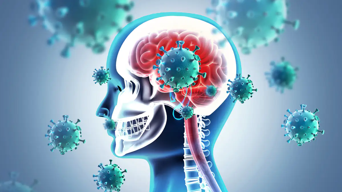 Mehrere Todesfälle in Italien: West-Nil-Virus befällt das Gehirn