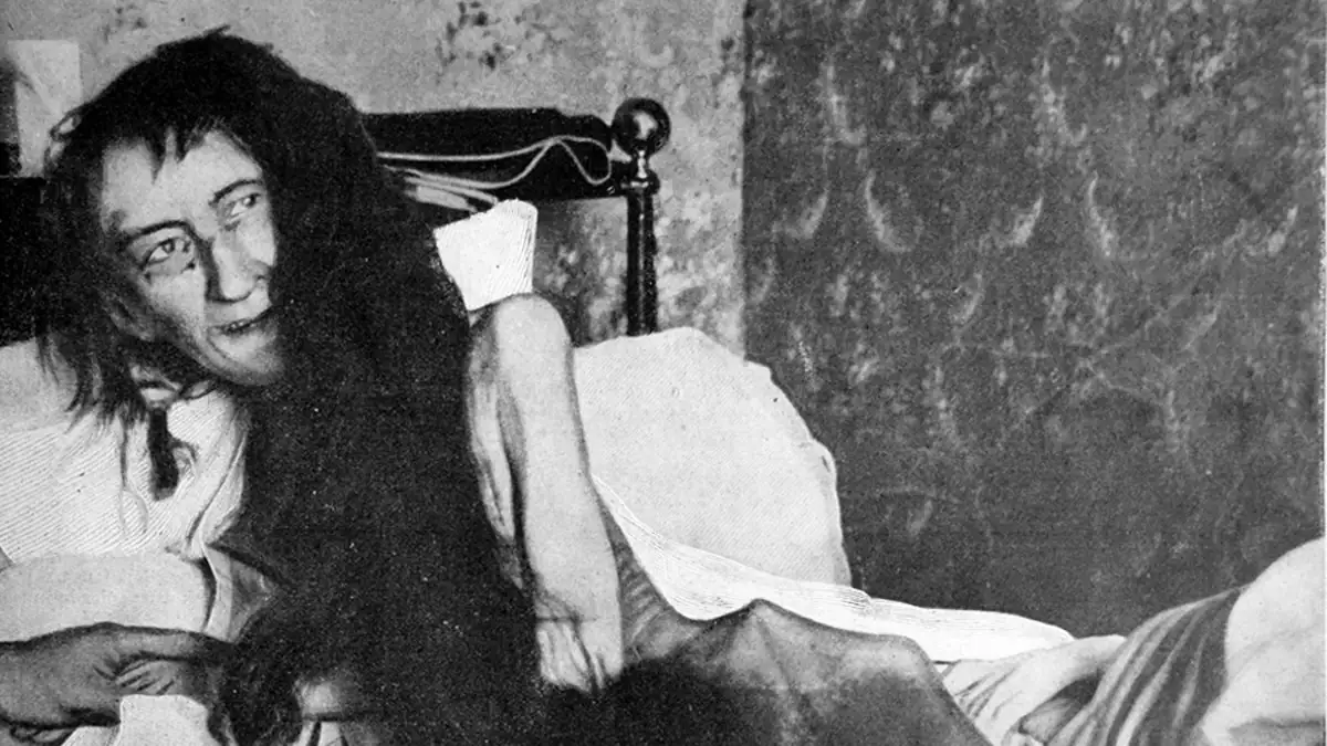 „Schrecklichstes Bild aller Zeiten“: Die traurige Geschichte von Blanche Monnier