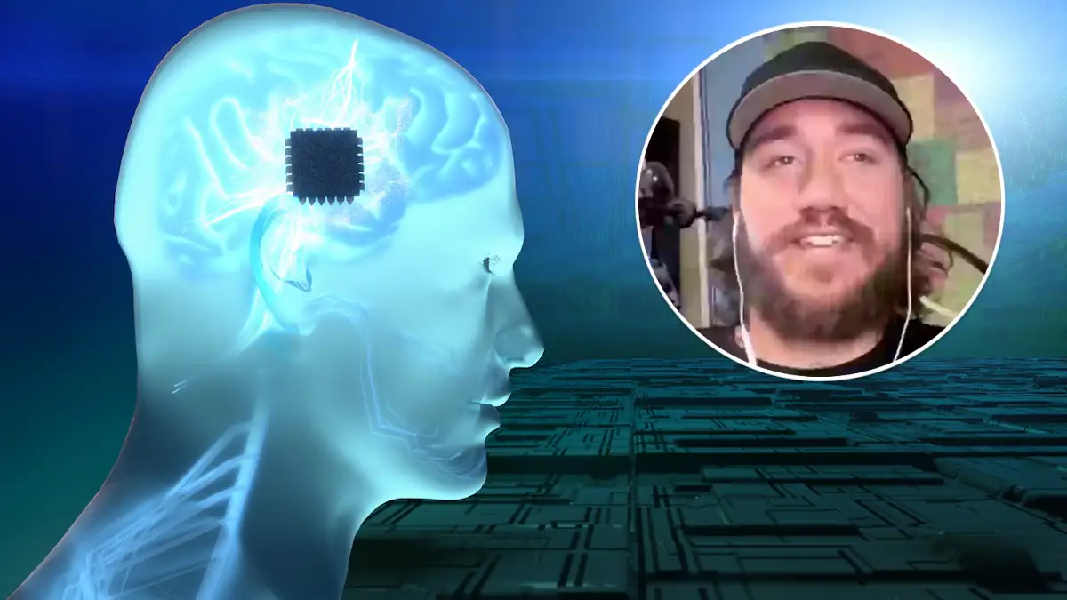 Gehirnimplantate von Elon Musk: Neuralink-Patient zeigt Bild, das er mit seinen Gedanken gemalt hat