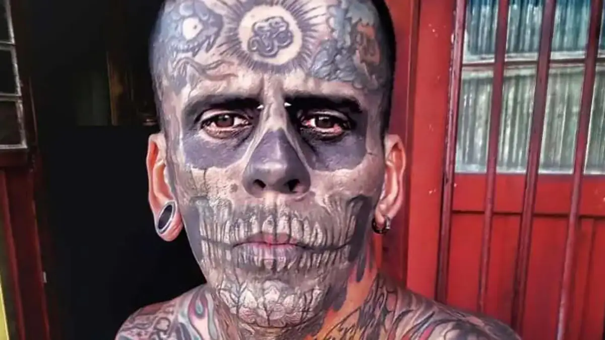 Leandro de Souza lässt sich 170 Tattoos entfernen – „dreimal schmerzhafter als Stechen“