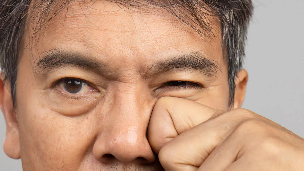 „Ozempic Face“: Mann berichtet von unerwünschten Nebenwirkungen der Abnehmspritze