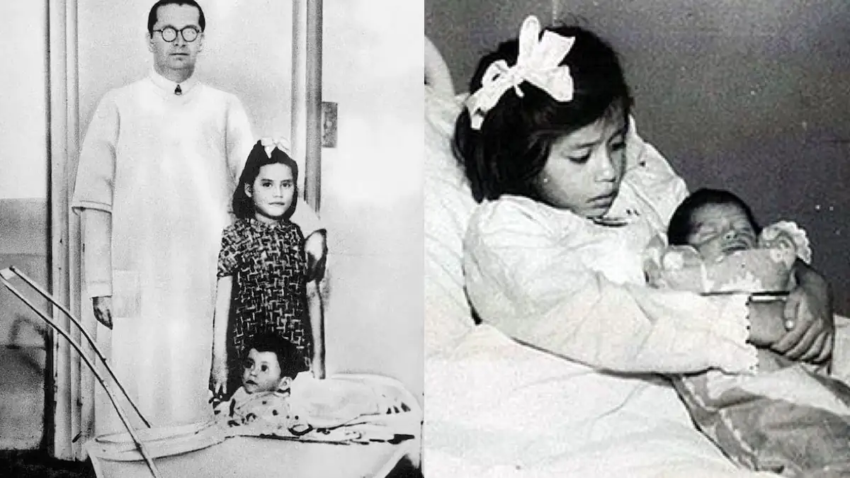 Baby mit 5 Jahren: Jüngste Mutter der Welt ist ein wissenschaftliches Phänomen