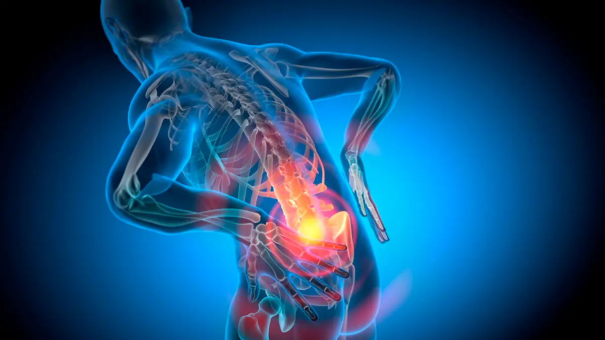 Versteckte Warnsignale: Wann man mit Rückenschmerzen unbedingt zum Arzt gehen sollte