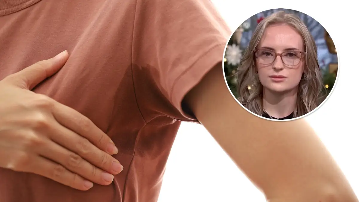 Bis zu 3 Liter Schweiß am Tag: 22-Jährige berichtet von ihrem Alltag mit unterschätzter Krankheit