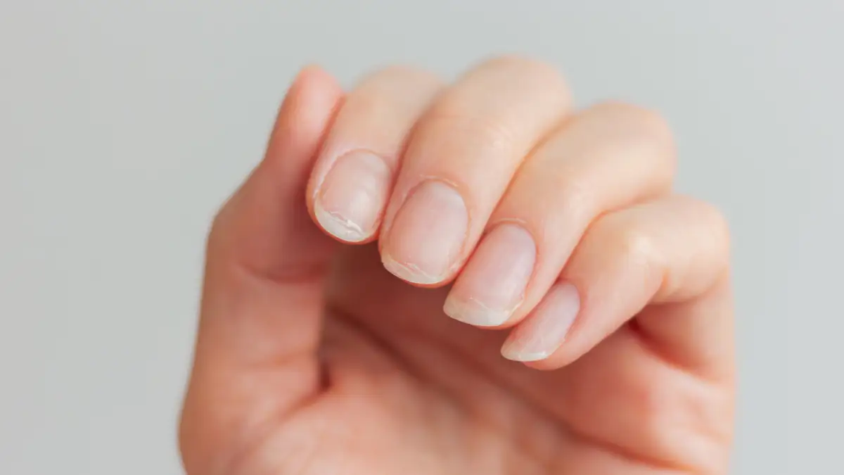 Betroffener warnt: Veränderung der Fingernägel kann Krebssymptom sein