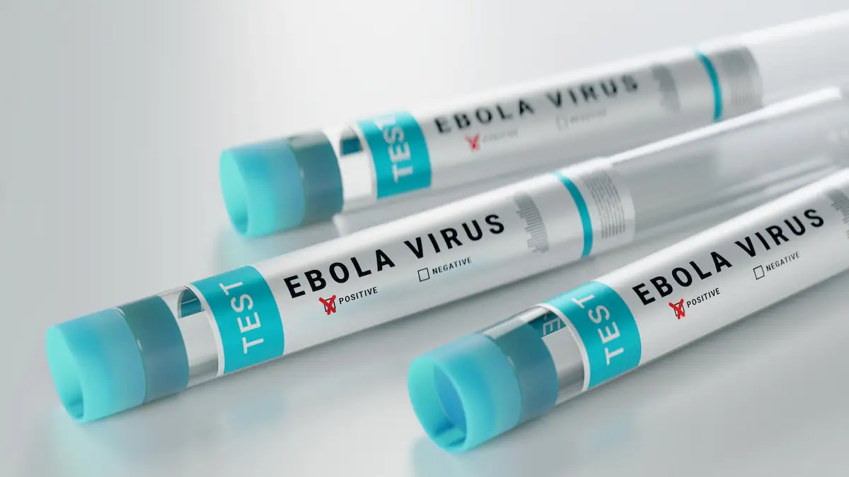 Frankreich meldet ersten Ebola-Fall: Wie groß ist die Gefahr?