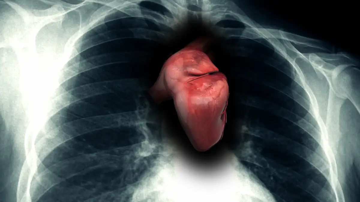 „Happy Heart Syndrom“: Frau landet wegen Glücklichseins im Krankenhaus