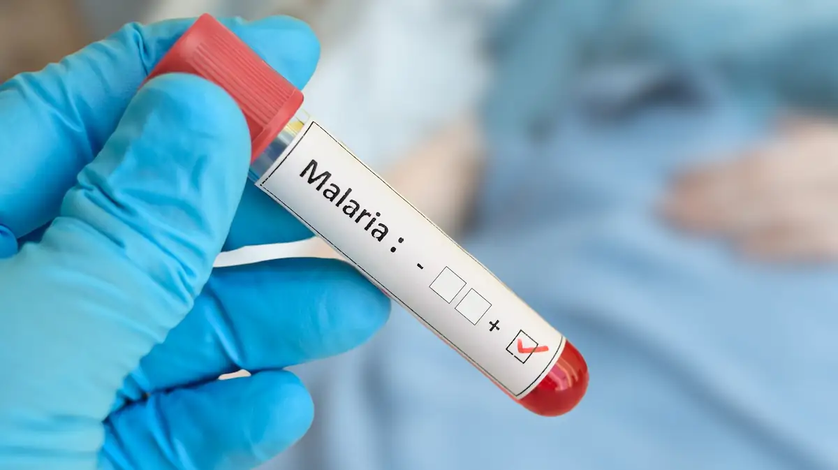 Nach Todesfällen am Flughafen: Weitere Malaria-Fälle in Frankfurt gemeldet