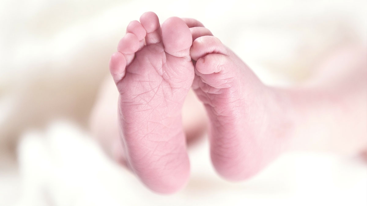 Triphallie: Baby wird mit drei Penissen geboren