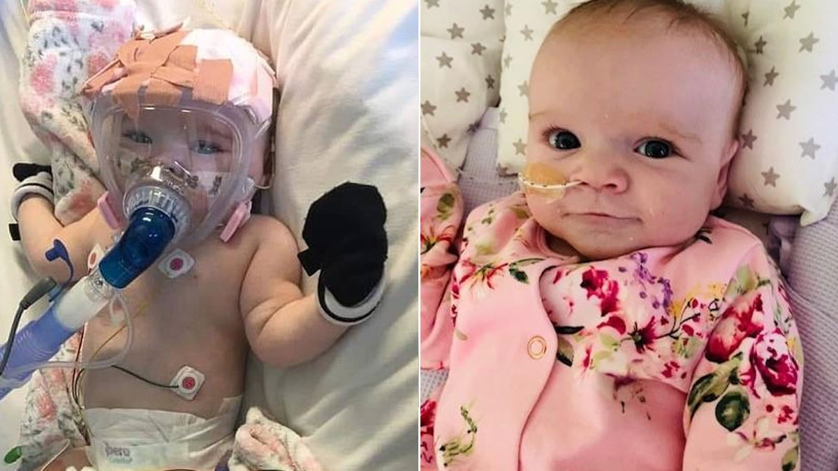 Sechs Monate altes Baby besiegt trotz Herz- und Lungenproblemen das Coronavirus