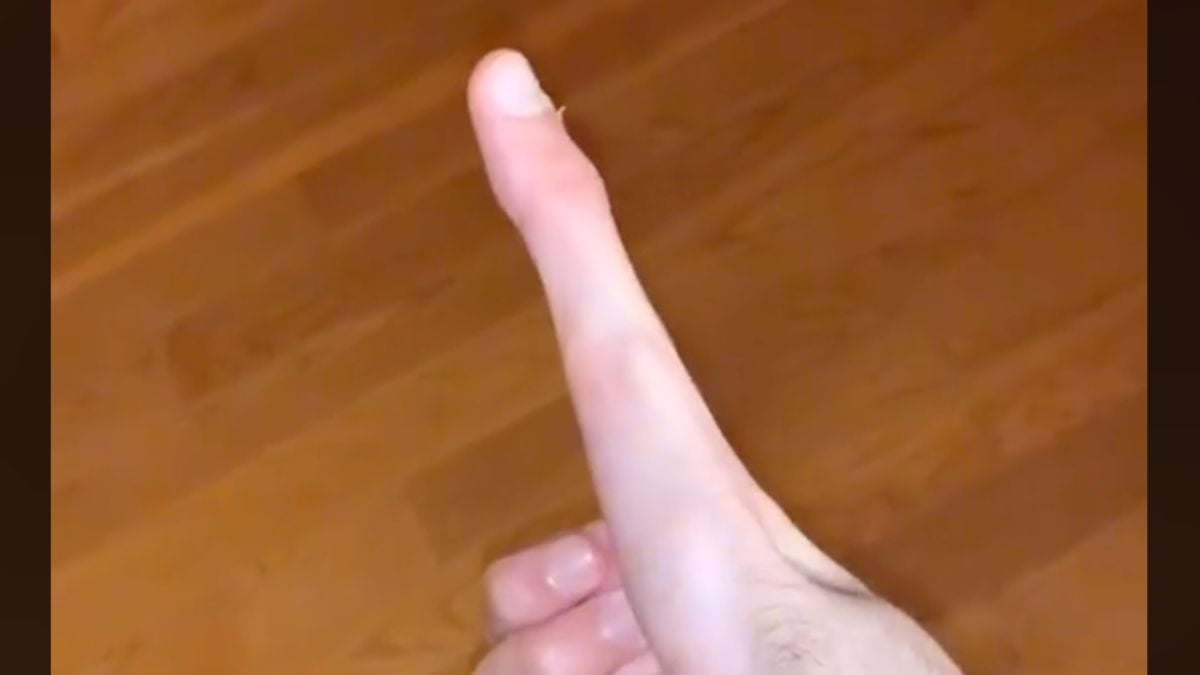 Riesiger „E.T.“-Finger: TikToker kann seinen Daumen ausfahren