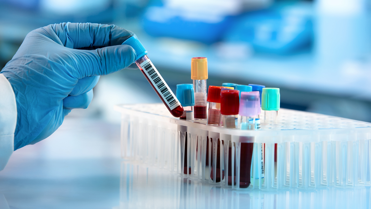 Jahrzehntealtes Rätsel gelöst: Forscher entdecken neuartige Blutgruppe