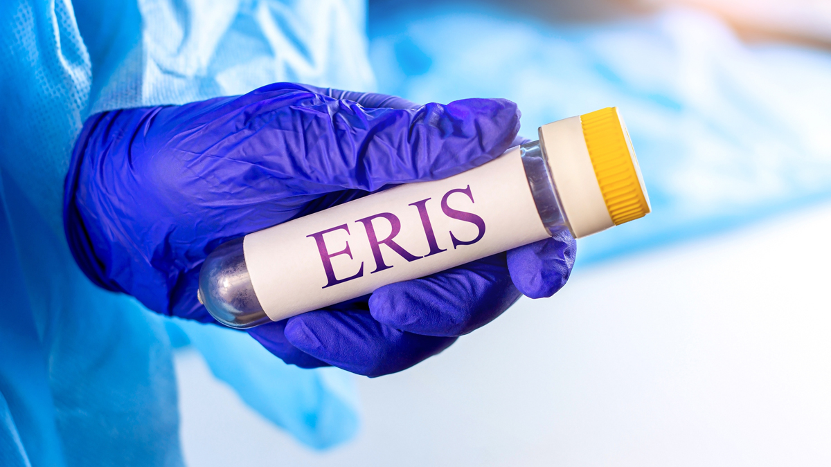 „Eris“: Das sind die Symptome der neuen Corona-Variante
